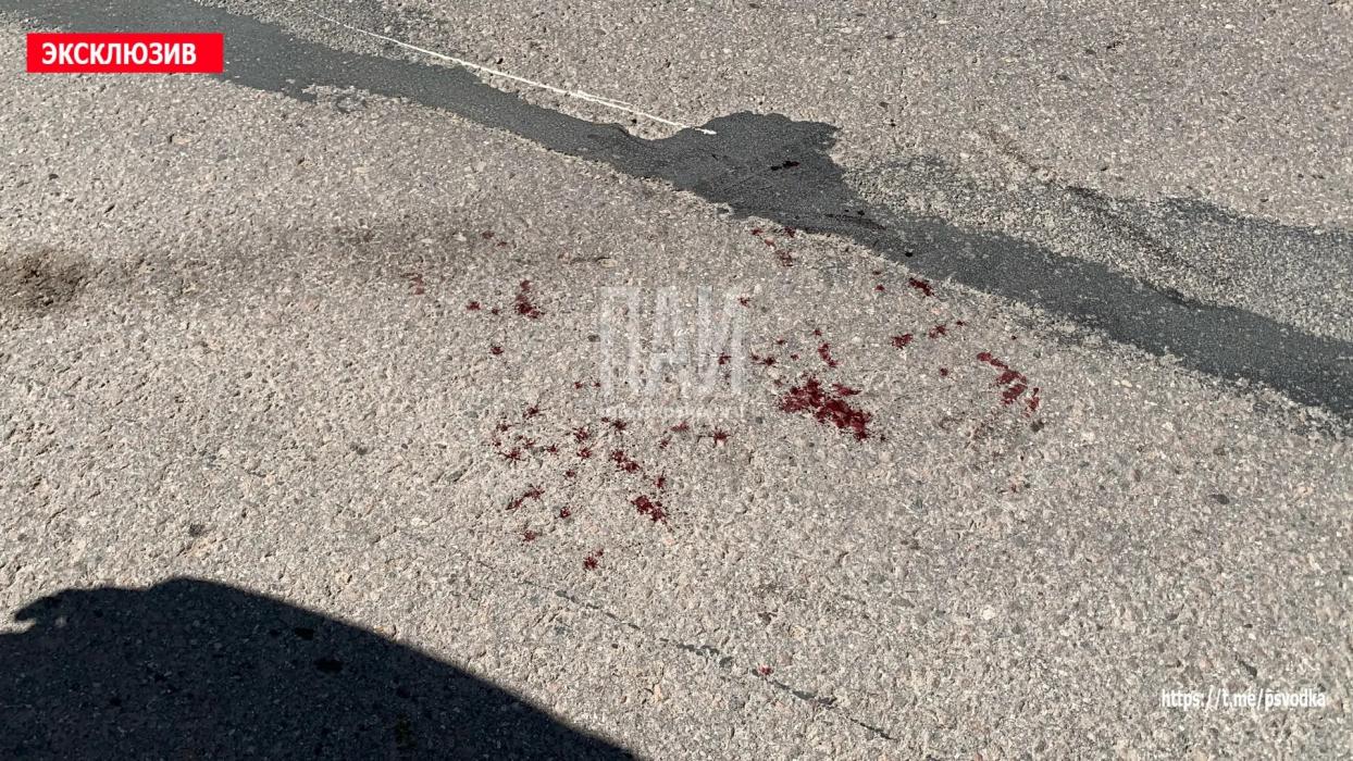 Пожилого мужчину на самокате сбили в Печорах