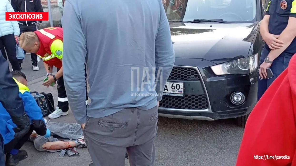 Водитель сбил девочку на самокате в Пскове 
