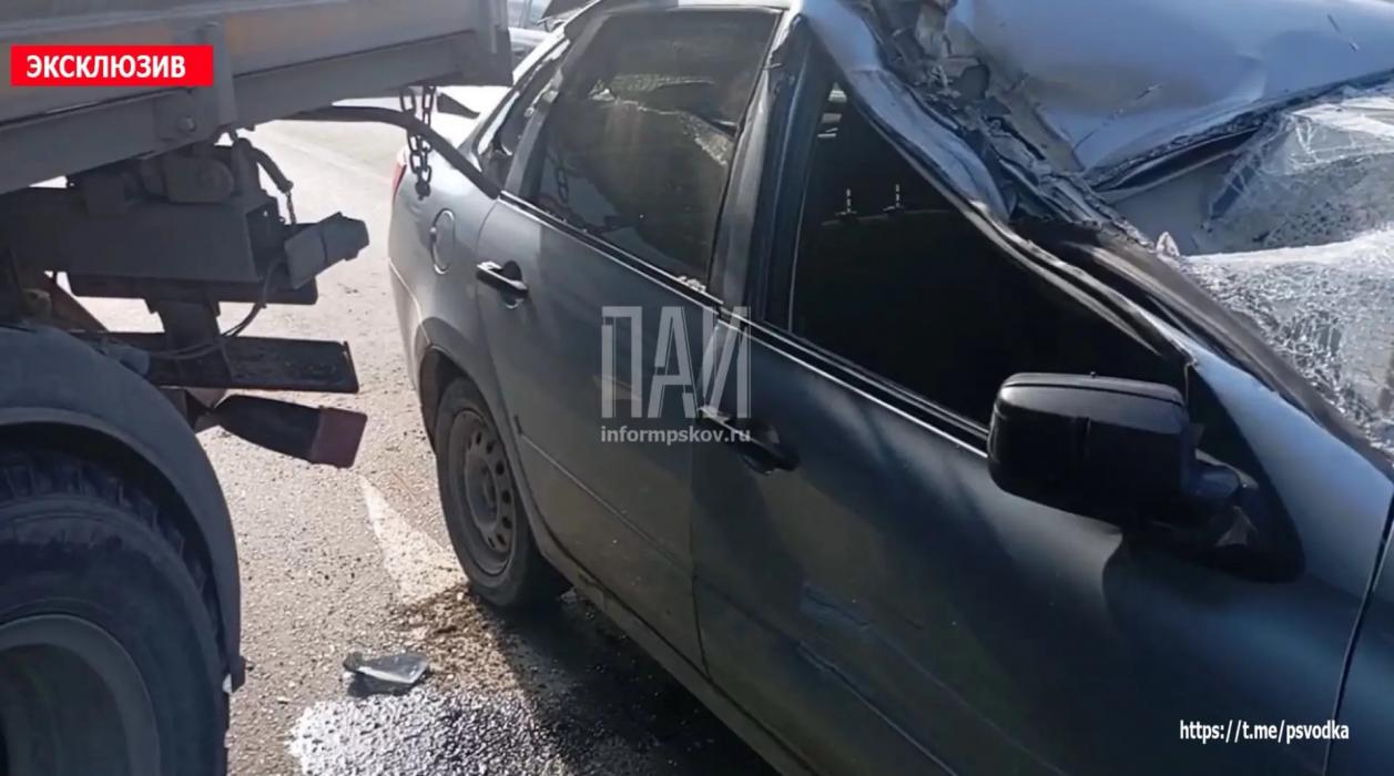 Мужчину госпитализировали после столкновения легковушки и самосвала в Пскове