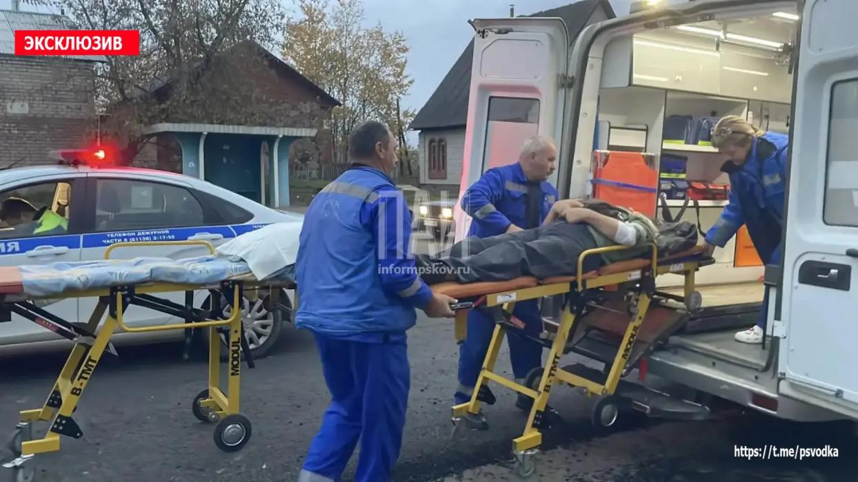 Автомобиль сбил 60-летнюю женщину на пешеходном переходе в Опочке