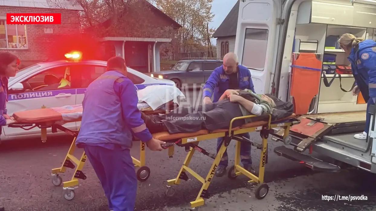 Автомобиль сбил 60-летнюю женщину на пешеходном переходе в Опочке