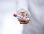 В Псковской области за сутки обнаружено 113 новых случаев заражения COVID-19
