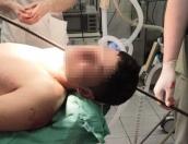Полутораметровую арматуру достали врачи из шеи пациента  