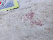 Дорожный знак упал на мужчину в городе Дно