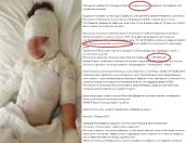 В Пскове опровергли фейк о пострадавшем при пожаре ребенке